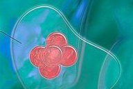 试管婴儿取卵前空卵泡B超能看出来吗？