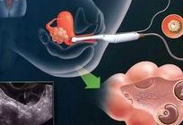 信阳罗山县试管婴儿哪里做？