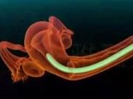 2026上海第三代试管婴儿大概费用是多少？